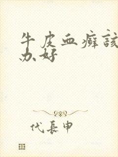 牛皮血癣该怎么办好