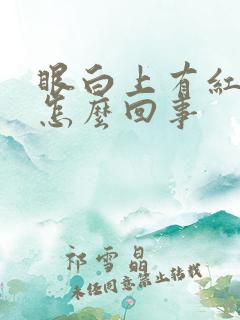 眼白上有红血丝怎么回事