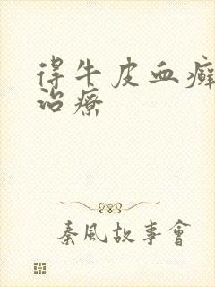 得牛皮血癣怎么治疗