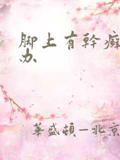 脚上有干癣怎么办