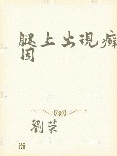 腿上出现癣的原因