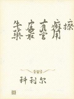 牛皮有癣擦什么药最管用