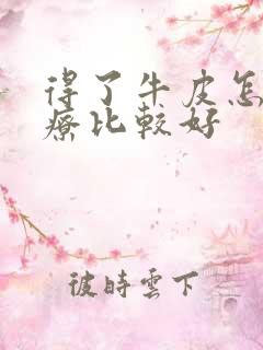 得了牛皮怎么治疗比较好