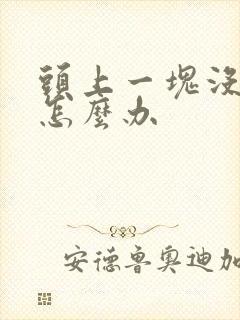 头上一块没头发怎么办