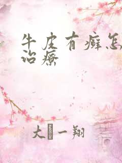 牛皮有癣怎样去治疗