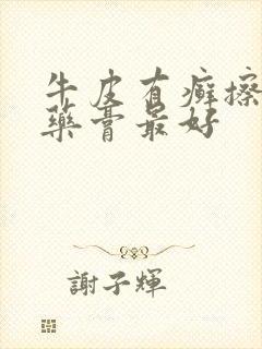 牛皮有癣擦什么药膏最好