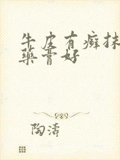 牛皮有癣抹什么药膏好