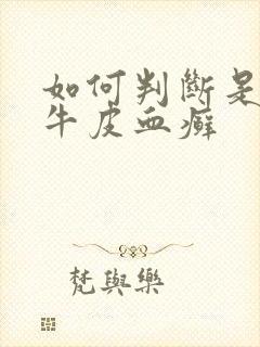 如何判断是不是牛皮血癣