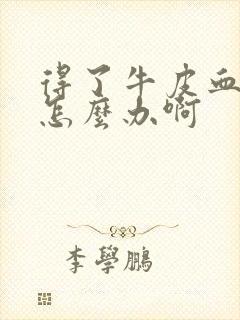 得了牛皮血癣该怎么办啊