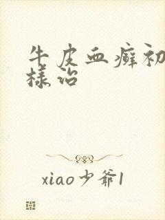 牛皮血癣初期怎样治