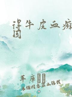 得牛皮血癣的原因