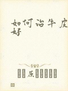 如何治牛皮有癣好