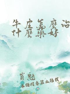 牛皮怎么治疗用什么药好