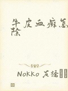 牛皮血癣怎么消除