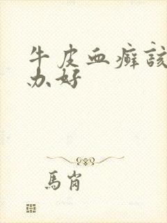 牛皮血癣该怎么办好