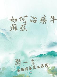 如何治疗牛皮有癣症