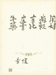 牛皮有癣用什么药膏比较好