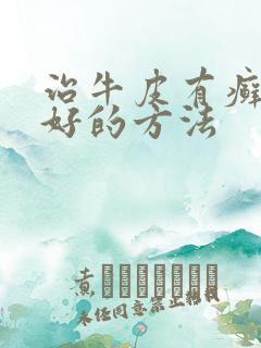 治牛皮有癣比较好的方法