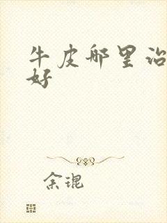 牛皮哪里治疗较好