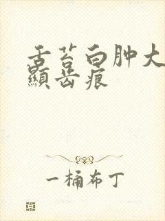 舌苔白肿大有明显齿痕