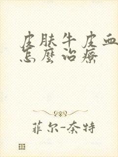 皮肤牛皮血癣该怎么治疗