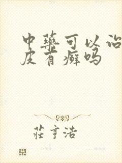 中药可以治疗牛皮有癣吗