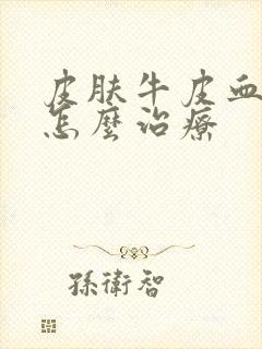 皮肤牛皮血癣该怎么治疗