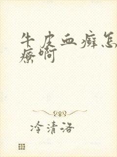 牛皮血癣怎么治疗啊