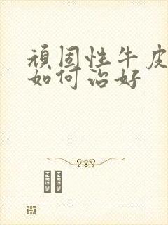 顽固性牛皮有癣如何治好