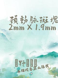 颈动脉斑块3.2mm×1.9mm算严重
