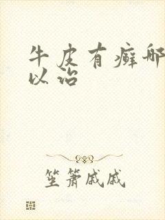 牛皮有癣哪里可以治