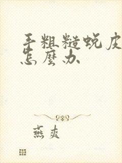 手粗糙蜕皮开裂怎么办