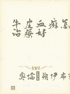 牛皮血癣怎么能治疗好