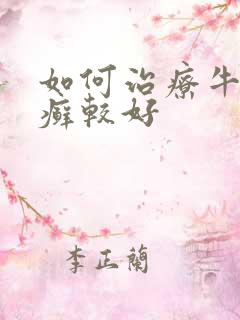 如何治疗牛皮有癣较好