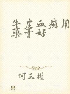 牛皮血癣用什么药膏好