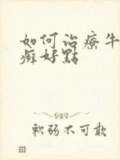 如何治疗牛皮有癣好点