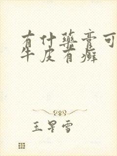 有什药膏可以治牛皮有癣