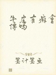 牛皮有癣会有遗传吗