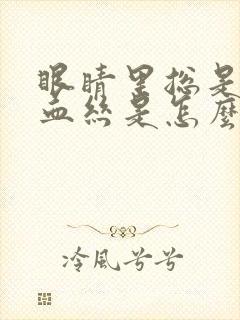 眼睛里总是有红血丝是怎么回事