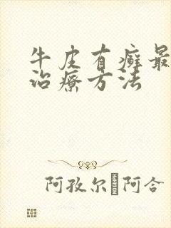 牛皮有癣最好的治疗方法