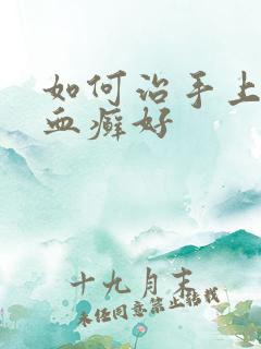 如何治手上牛皮血癣好