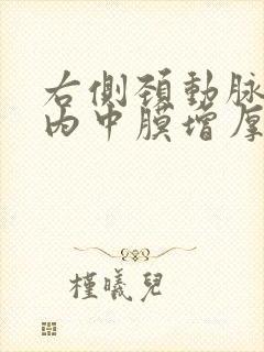 右侧颈动脉局部内中膜增厚伴斑块形成