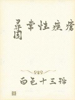 寻常性痤疮的病因