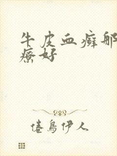 牛皮血癣那里治疗好