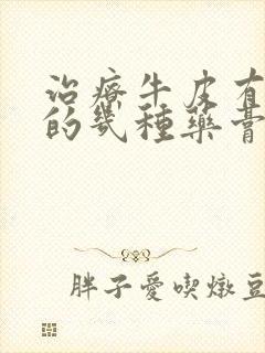 治疗牛皮有癣的的几种药膏