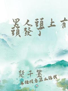 男人头上有点掉头发了