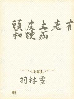 头皮上老有疙瘩和硬痂