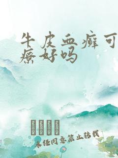 牛皮血癣可以治疗好吗