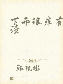 下面很痒有豆腐渣