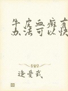 牛皮血癣有什么办法可以快速好